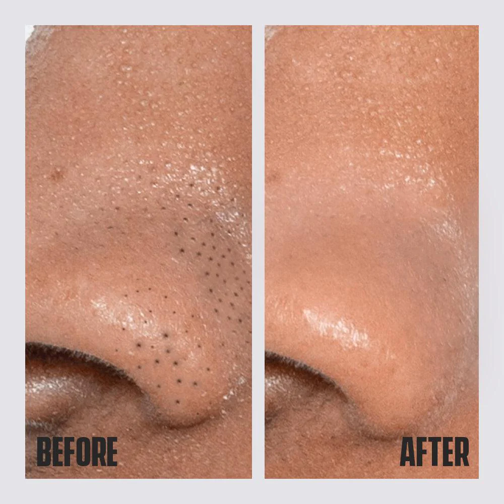 Charcoal Face Mask - Image 5